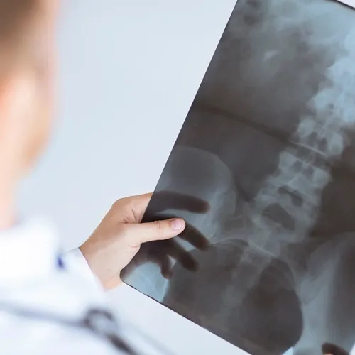 Physician reviewing spinal x-ray results during a patient evaluation